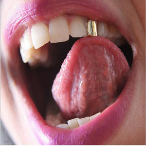 Single Tooth Cap