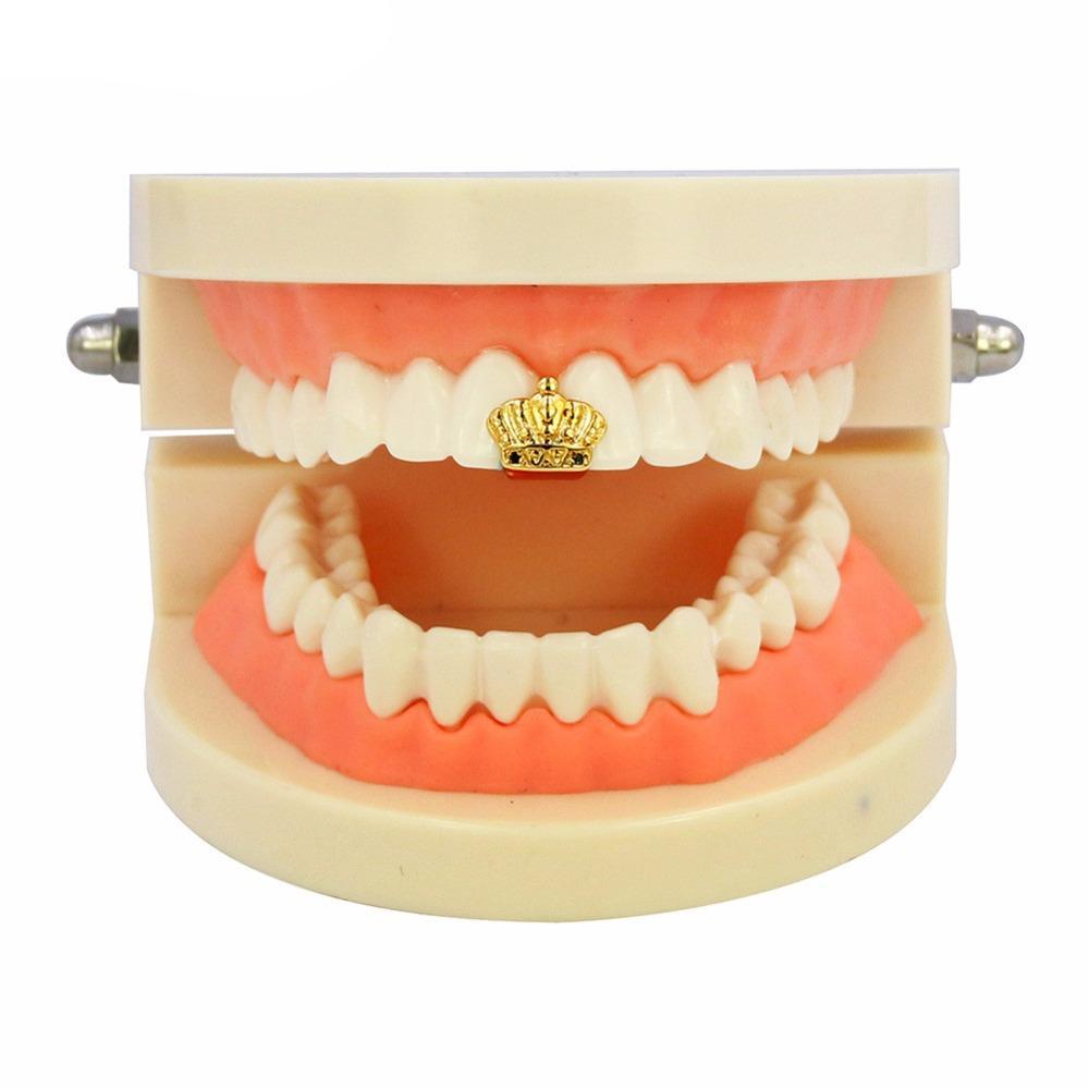 Gold Crown Tooth