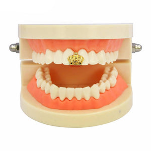 Gold Crown Tooth